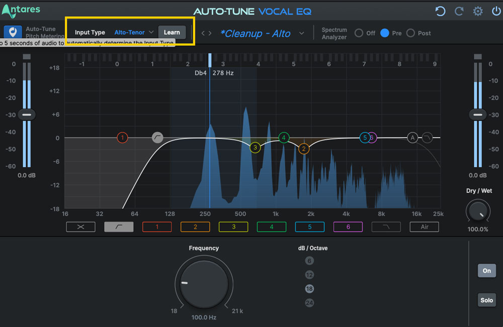 Autotune-vocaleq